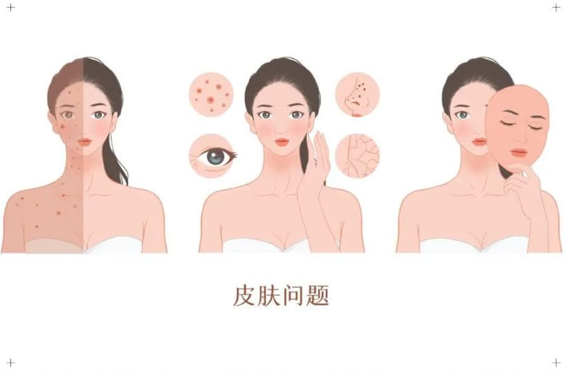 抗衰还能解决痘坑、妊娠纹、狐臭……黄金微针真有这么神奇吗？丨科普篇